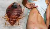 Quality Affordable Pest Control Toronto photo 7